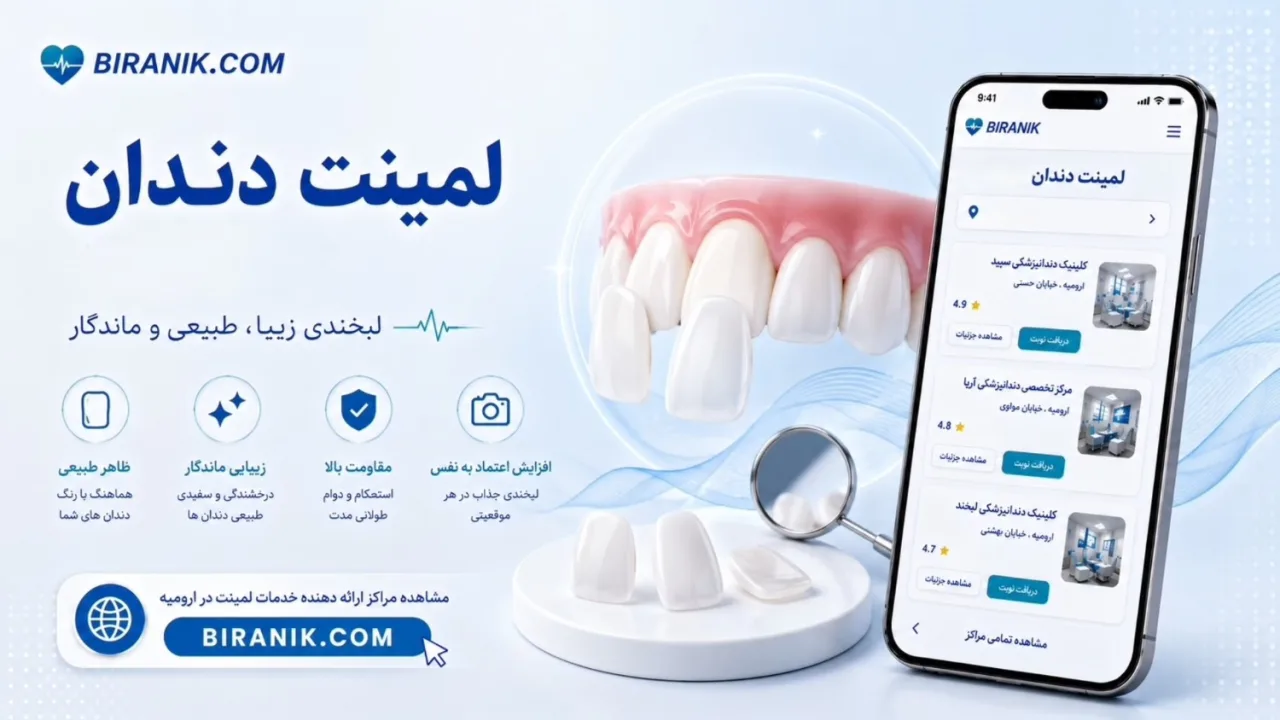 لمینت دندان
