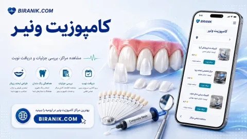 کامپوزیت ونیر