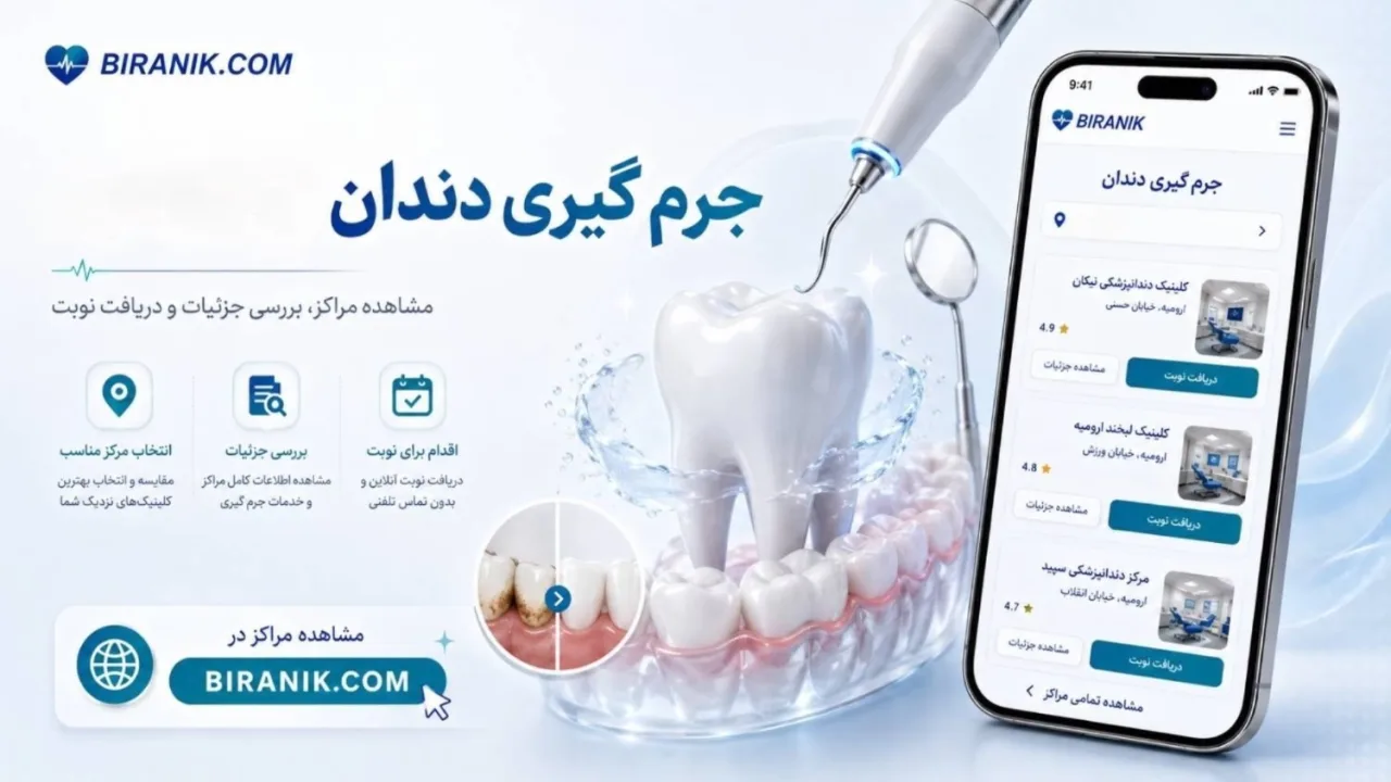 جرم گیری دندان