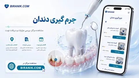 جرم گیری دندان