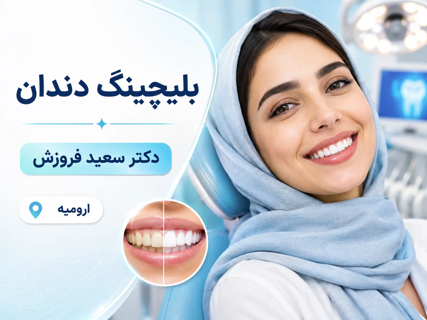 بلیچینگ دندان با رویکرد زیبایی و ترمیمی 🦷✨