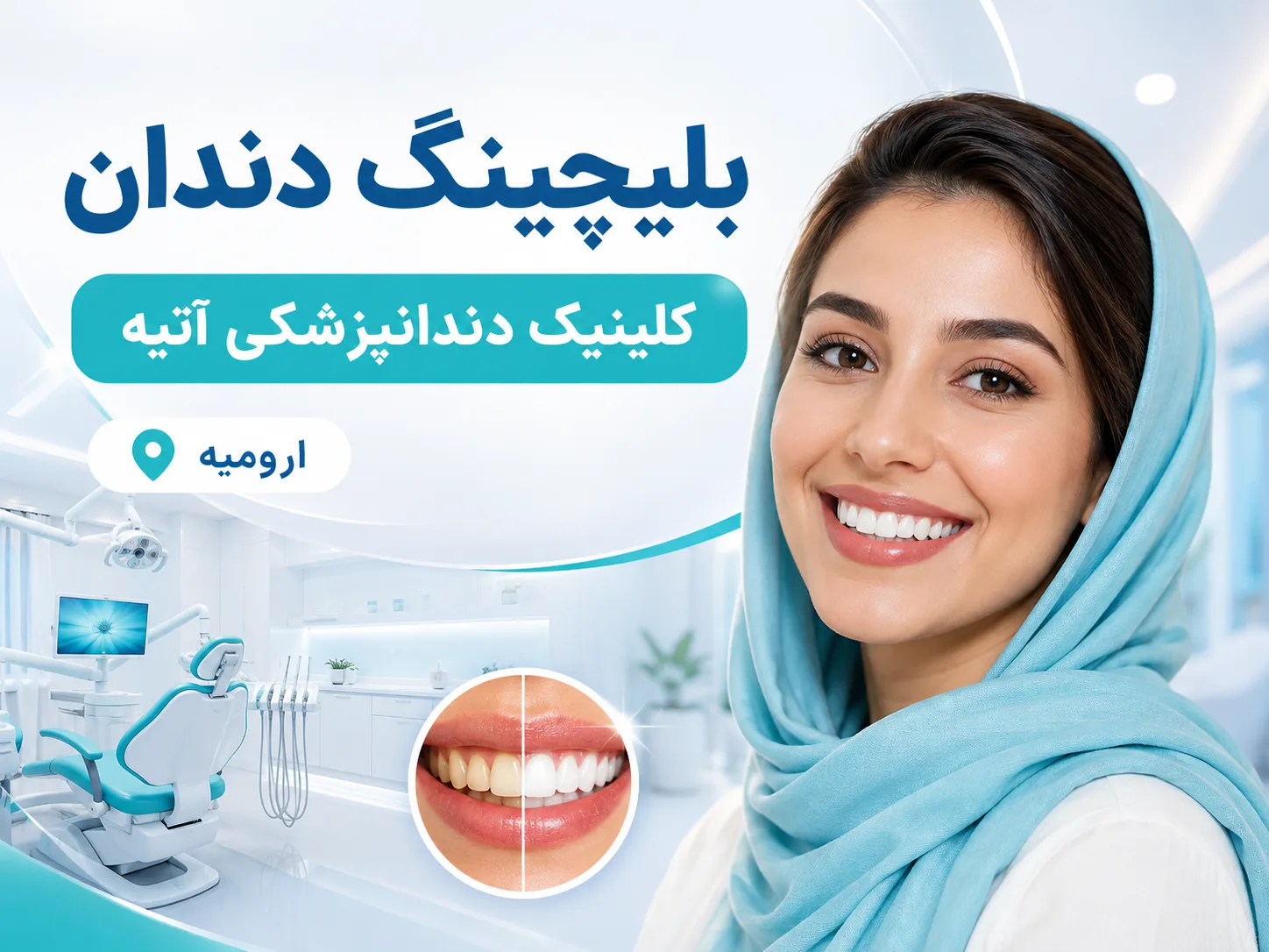 رزرو نوبت مطب برای بلیچینگ دندان (سفید کردن دندان)