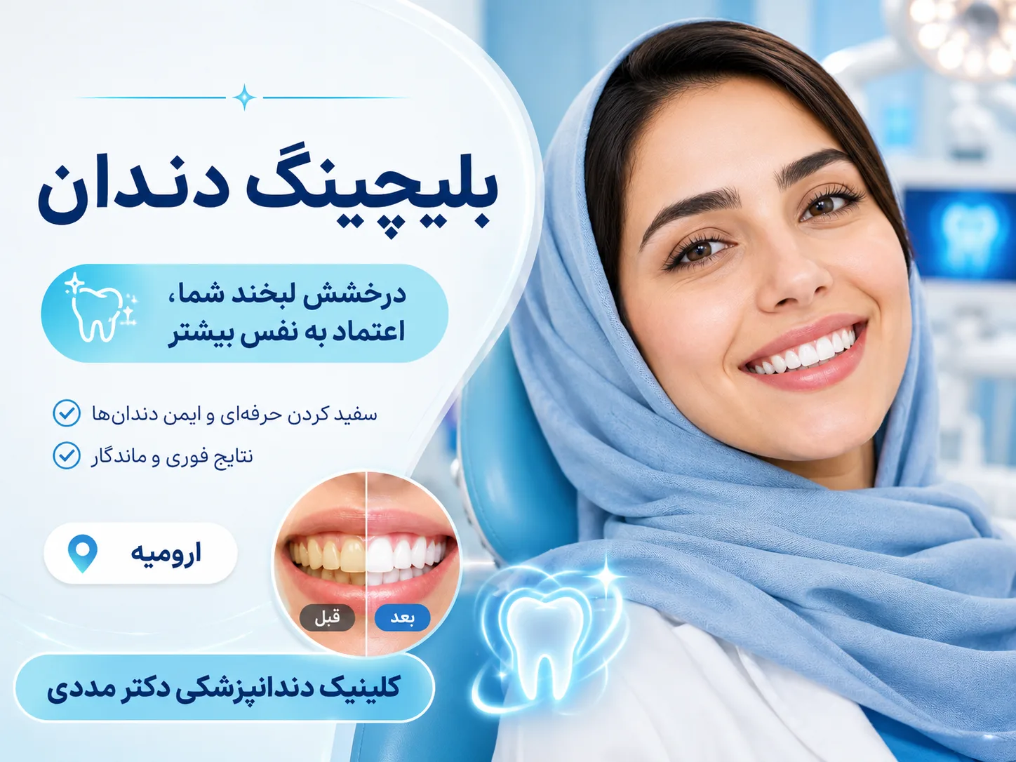 رزرو نوبت مطب برای بلیچینگ دندان (سفید کردن دندان)