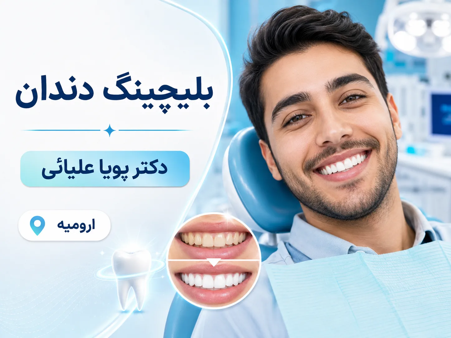 لبخندی روشن‌تر با بلیچینگ مطبی و خانگی 🦷✨