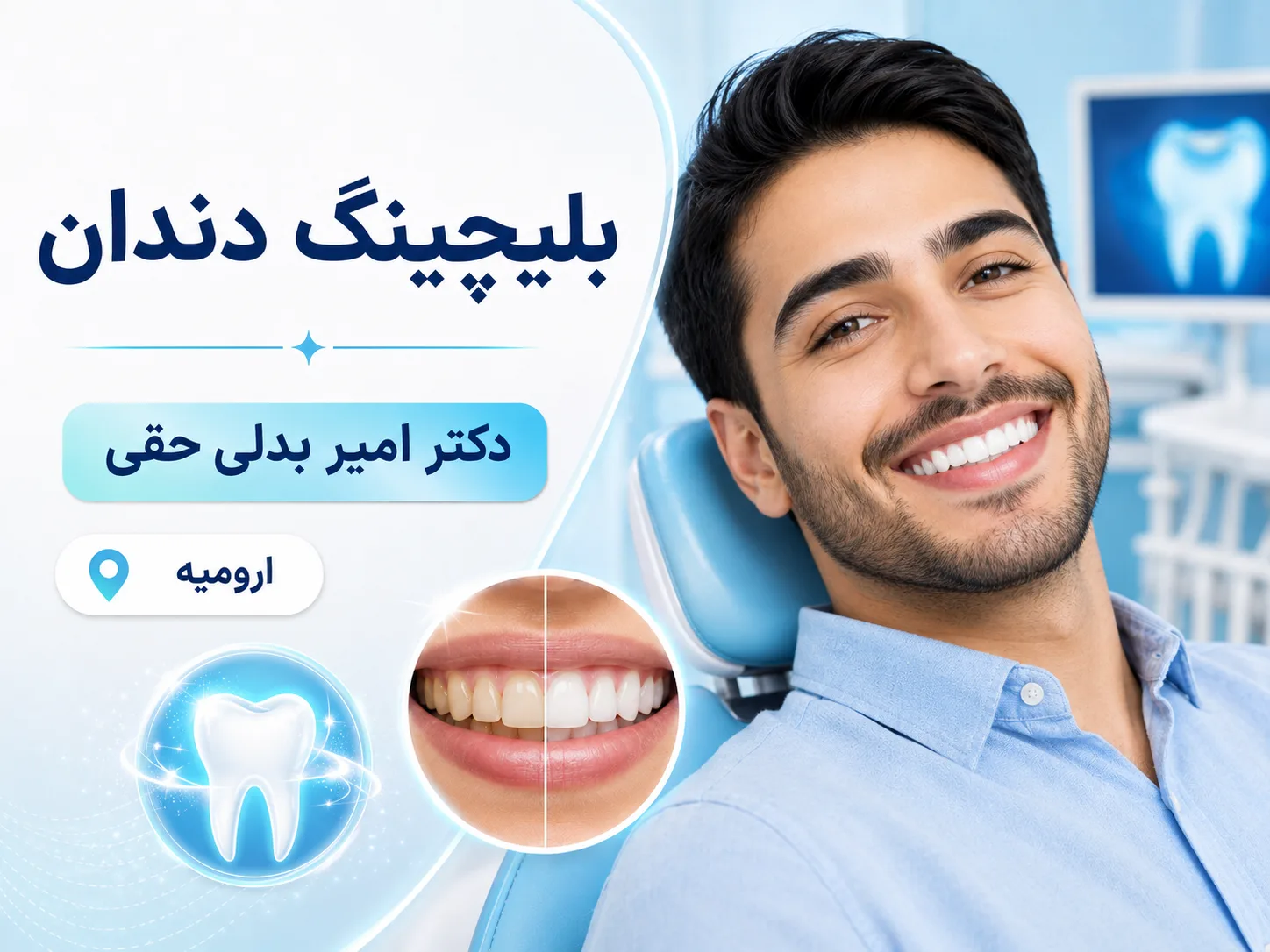 بلیچینگ یک‌جلسه‌ای دندان؛ لبخندی روشن‌تر بدون تغییر فرم دندان‌ها 🦷✨