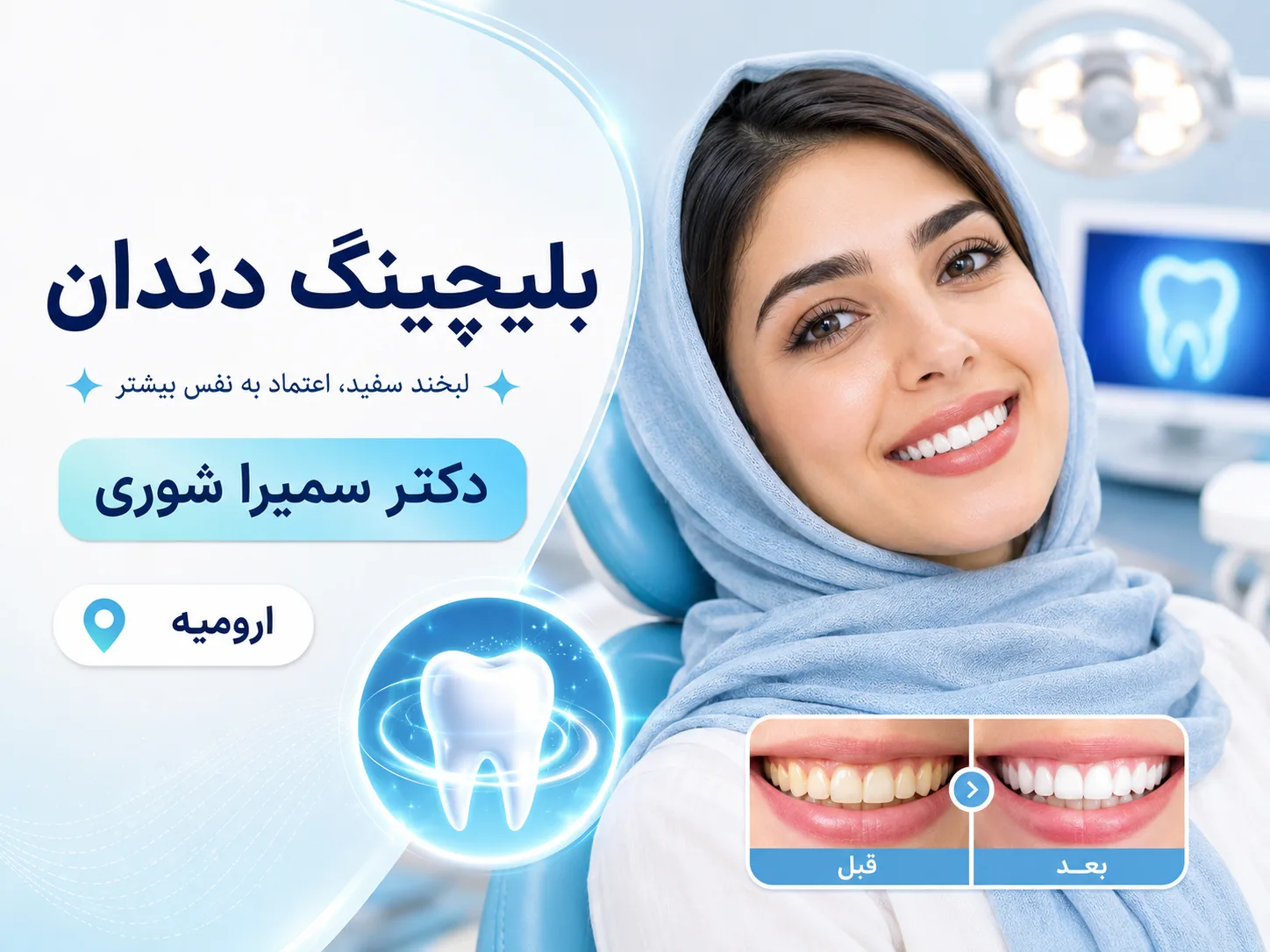 بلیچینگ دندان با متریال آمریکایی و ایرانی در مطب دکتر سمیرا شوری ✨🦷
