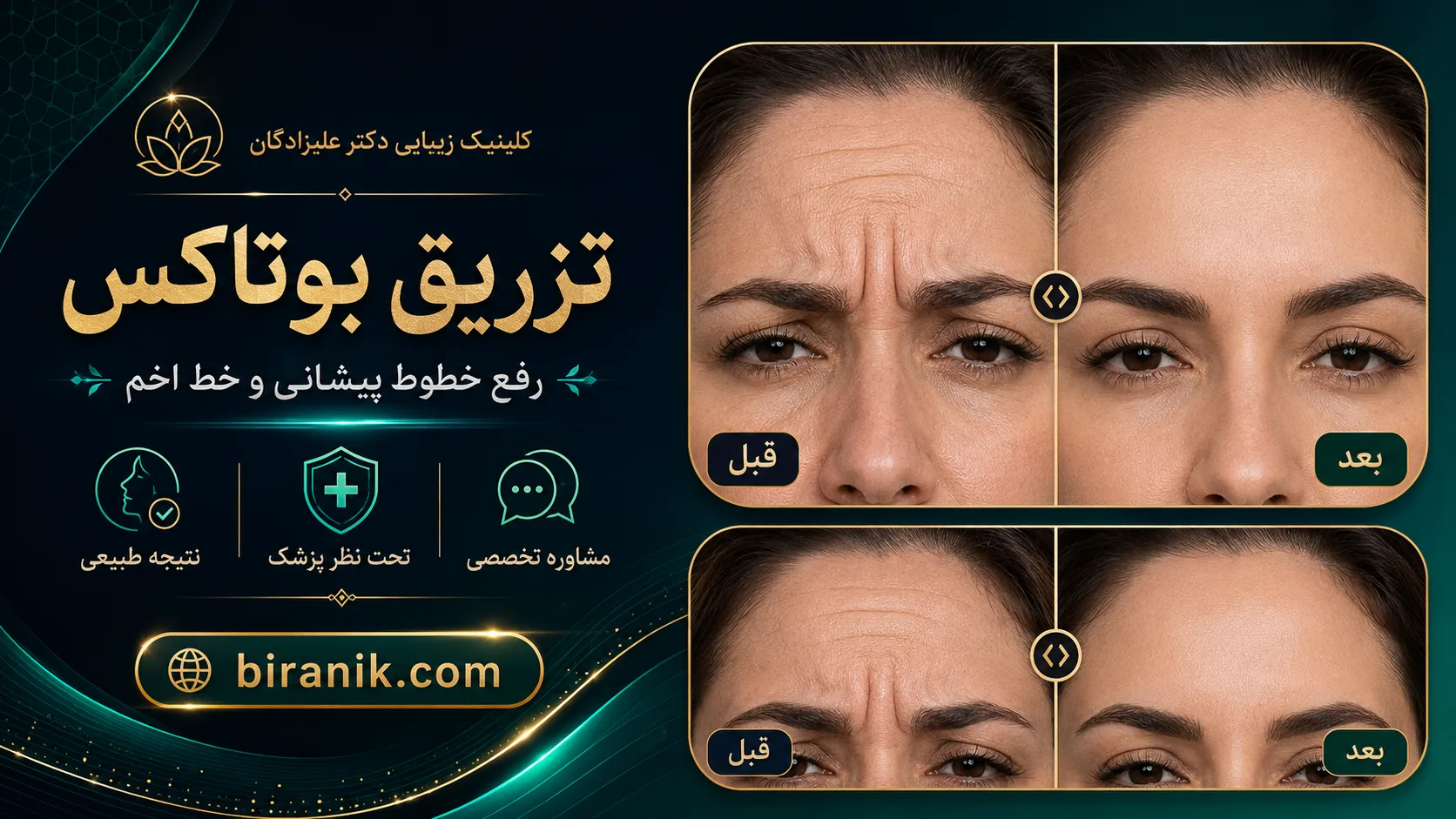 تزریق بوتاکس در مطب دکتر علیزادگان