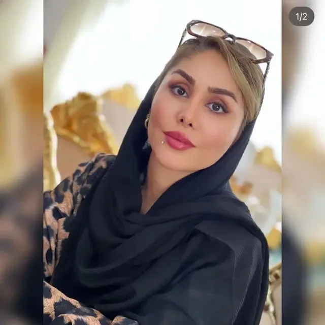 رزرو نوبت مطب برای بوتاکس